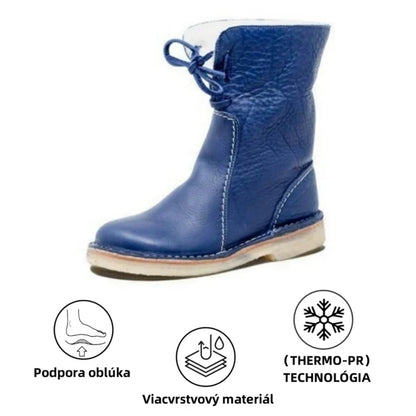 🎉 Dnešná špeciálna ponuka: 70% zľava - Nenechajte si to ujsť! ⏰ Ergonomicky navrhnutá ortopedická zimná obuv na úľavu od bolesti nôh, kolien a chrbta.